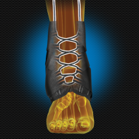 Active Ankle® AS1 PRO™ (potītes ortoze) 2XL